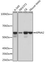 KPNA2 Antibody in Western Blot (WB)