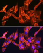 JNK1/JNK3 Antibody in Immunocytochemistry (ICC/IF)