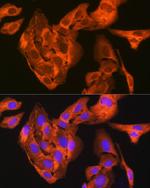 JNK1/JNK3 Antibody in Immunocytochemistry (ICC/IF)