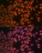 CYP17A1 Antibody in Immunocytochemistry (ICC/IF)