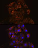 UPF1 Antibody in Immunocytochemistry (ICC/IF)