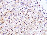 PSMA3 Antibody in Immunohistochemistry (Paraffin) (IHC (P))