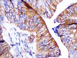 PAR2 Antibody in Immunohistochemistry (Paraffin) (IHC (P))