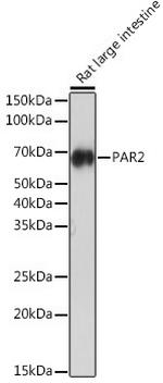 PAR2 Antibody in Western Blot (WB)