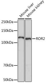 ROR2 Antibody in Western Blot (WB)