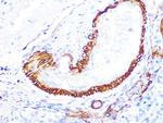 LDHB Antibody in Immunohistochemistry (Paraffin) (IHC (P))