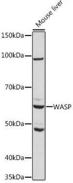 WASP Antibody in Western Blot (WB)