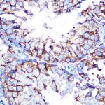 CHRM2 Antibody in Immunohistochemistry (Paraffin) (IHC (P))