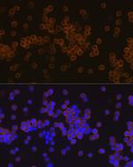 PLCG2 Antibody in Immunocytochemistry (ICC/IF)