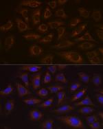 UBE2C Antibody in Immunocytochemistry (ICC/IF)