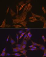 KAP3 Antibody in Immunocytochemistry (ICC/IF)