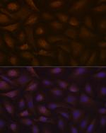 KAP3 Antibody in Immunocytochemistry (ICC/IF)