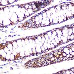 DLD Antibody in Immunohistochemistry (Paraffin) (IHC (P))