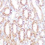 DLD Antibody in Immunohistochemistry (Paraffin) (IHC (P))