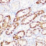 ANGPTL3 Antibody in Immunohistochemistry (Paraffin) (IHC (P))