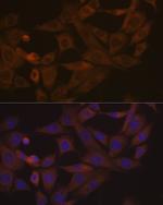 Desmoglein 3 Antibody in Immunocytochemistry (ICC/IF)