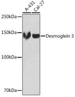 Desmoglein 3 Antibody in Western Blot (WB)