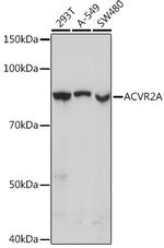 ACVR2A Antibody in Western Blot (WB)