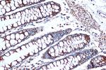 HSPE1 Antibody in Immunohistochemistry (Paraffin) (IHC (P))