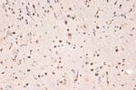 DDX17 Antibody in Immunohistochemistry (Paraffin) (IHC (P))