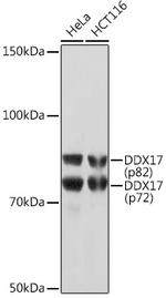 DDX17 Antibody in Western Blot (WB)