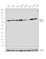 DCP1A Antibody in Western Blot (WB)