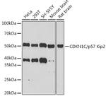 p57 Kip2 Antibody in Western Blot (WB)