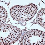 ILF3 Antibody in Immunohistochemistry (Paraffin) (IHC (P))