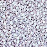 ILF3 Antibody in Immunohistochemistry (Paraffin) (IHC (P))