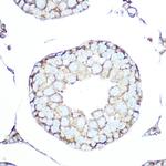 SSTR5 Antibody in Immunohistochemistry (Paraffin) (IHC (P))