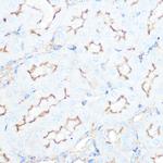 SSTR5 Antibody in Immunohistochemistry (Paraffin) (IHC (P))