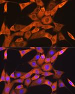 FKBP8 Antibody in Immunocytochemistry (ICC/IF)