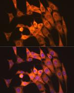 Calpain 1 Antibody in Immunocytochemistry (ICC/IF)