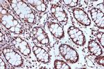 MSH2 Antibody in Immunohistochemistry (Paraffin) (IHC (P))