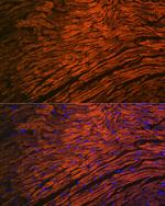 MYL2 Antibody in Immunohistochemistry (Paraffin) (IHC (P))