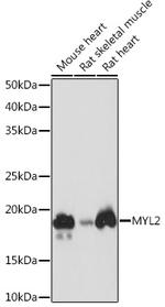 MYL2 Antibody in Western Blot (WB)