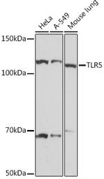 TLR5 Antibody in Western Blot (WB)