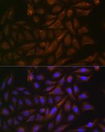 VAMP3 Antibody in Immunocytochemistry (ICC/IF)