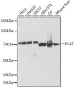 DLAT Antibody in Western Blot (WB)