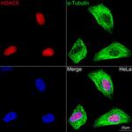 HDAC8 Antibody in Immunocytochemistry (ICC/IF)