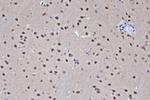 HDAC8 Antibody in Immunohistochemistry (Paraffin) (IHC (P))