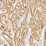 PDK1 Antibody in Immunohistochemistry (Paraffin) (IHC (P))