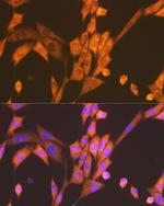 Raptor Antibody in Immunocytochemistry (ICC/IF)