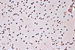 Histone Macro-H2A.1 Antibody in Immunohistochemistry (Paraffin) (IHC (P))