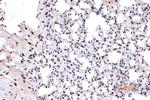 Histone Macro-H2A.1 Antibody in Immunohistochemistry (Paraffin) (IHC (P))