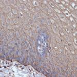 TMPRSS2 Antibody in Immunohistochemistry (Paraffin) (IHC (P))