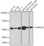 TMPRSS2 Antibody in Western Blot (WB)