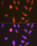 LGR6 Antibody in Immunocytochemistry (ICC/IF)