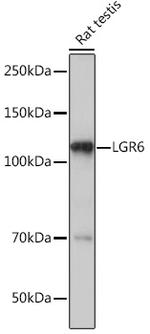 LGR6 Antibody in Western Blot (WB)