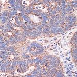 REA Antibody in Immunohistochemistry (Paraffin) (IHC (P))